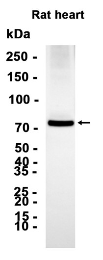 Phospho-PKC alpha (Thr497) (YD34855) Rabbit mAb