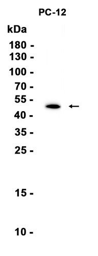 AYD11074