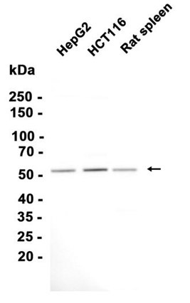 AYD14218