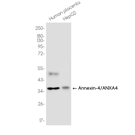 AYD13296