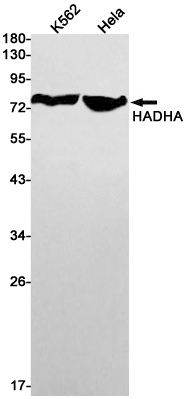 AYD14378