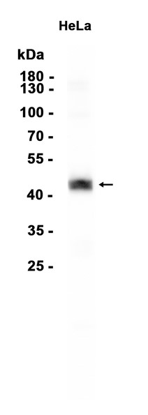 Cytokeratin 18 (YD14093) Rabbit mAb