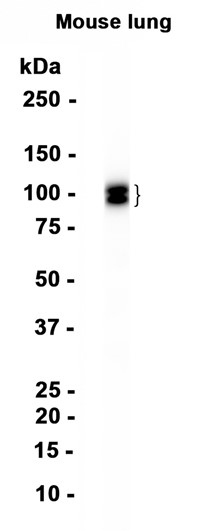 CD31 (YD20603) Rabbit mAb