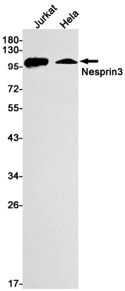 AYD13844