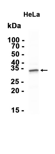 AYD11065