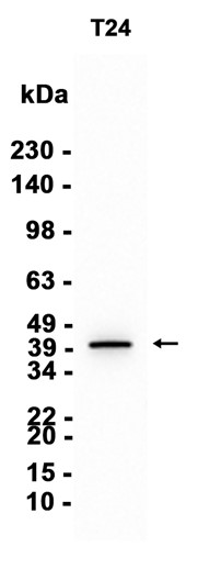 AYD14901