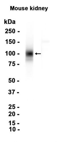 AYD14723