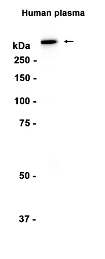AYD14297