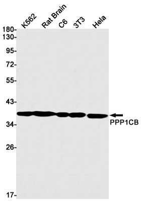 AYD14193