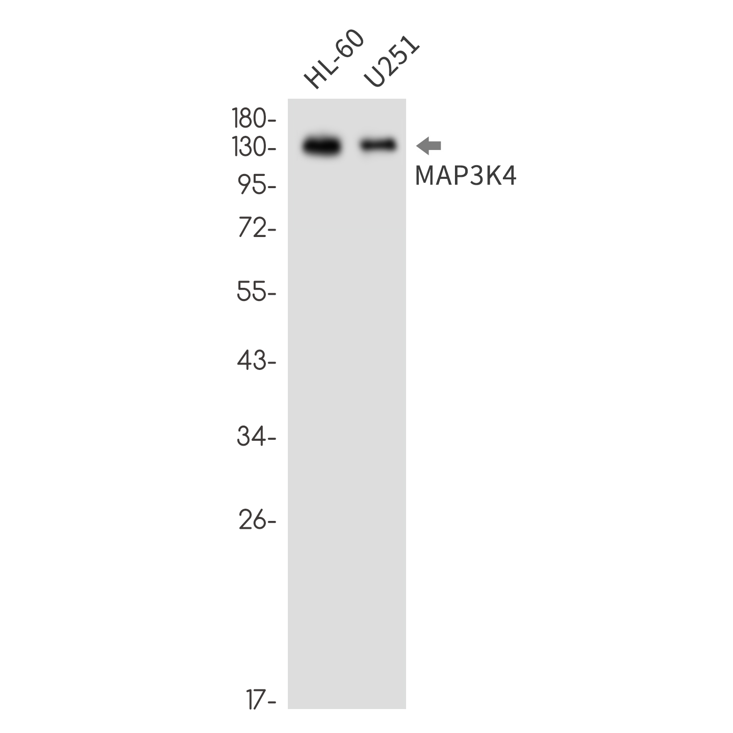 MAP3K4 (YD31191) Rabbit mAb