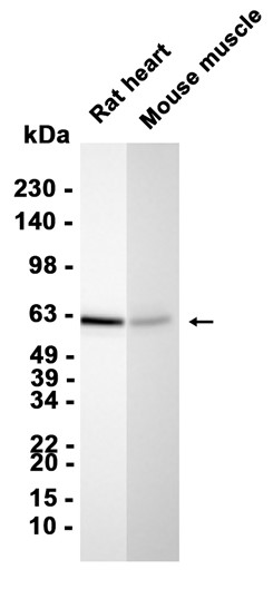 Phospho-Smad2 (Thr8)/Smad3 (Thr8) (YD35937) Rabbit mAb