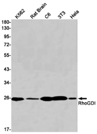 AYD11391