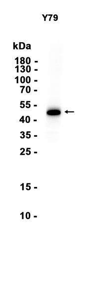AYD14961