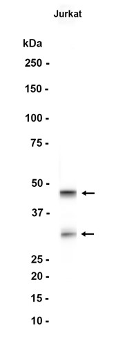 Caspase-2 (YD35455) Rabbit mAb