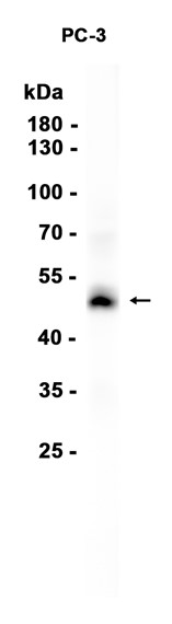 AYD15833