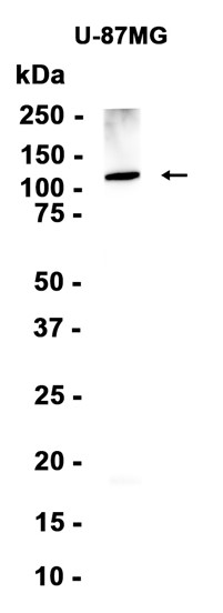 AYD13386