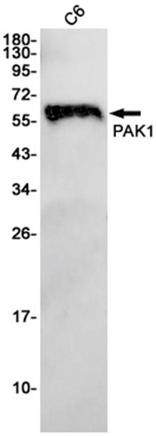 PAK1 (YD17011) Rabbit mAb