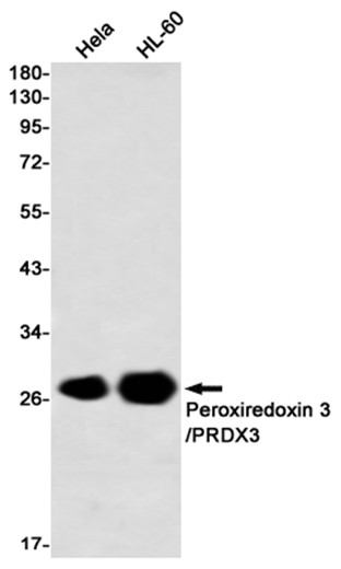 Peroxiredoxin 3 (YD32672) Rabbit mAb