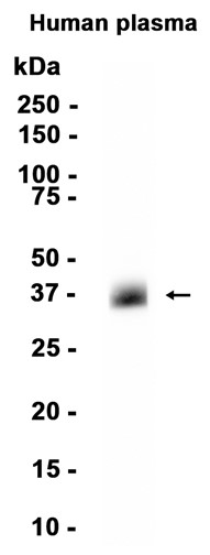 AYD15540