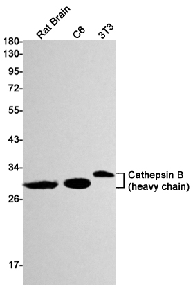 Cathepsin B (YD18146) Rabbit mAb