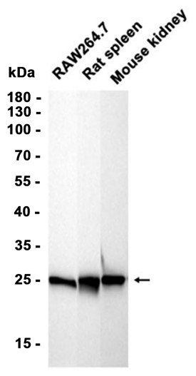 AYD11568