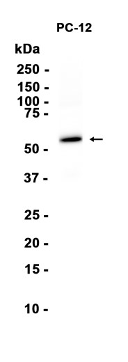 AYD16210