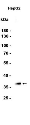 AYD13641