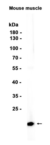 AYD15850
