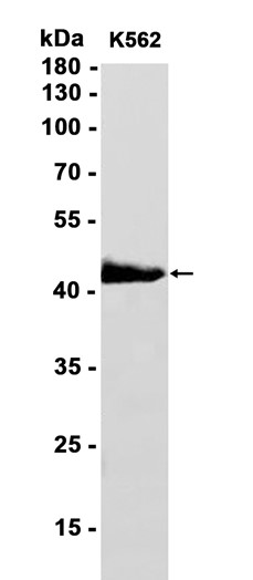AYD12258