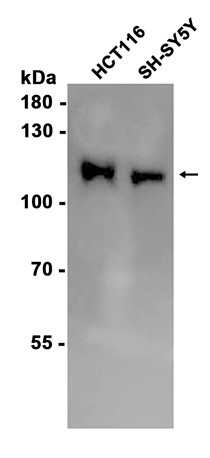 PI3-Kinase p110 beta (YD12789) Rabbit mAb