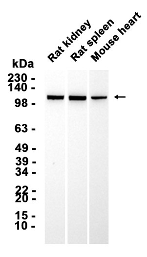AYD11158