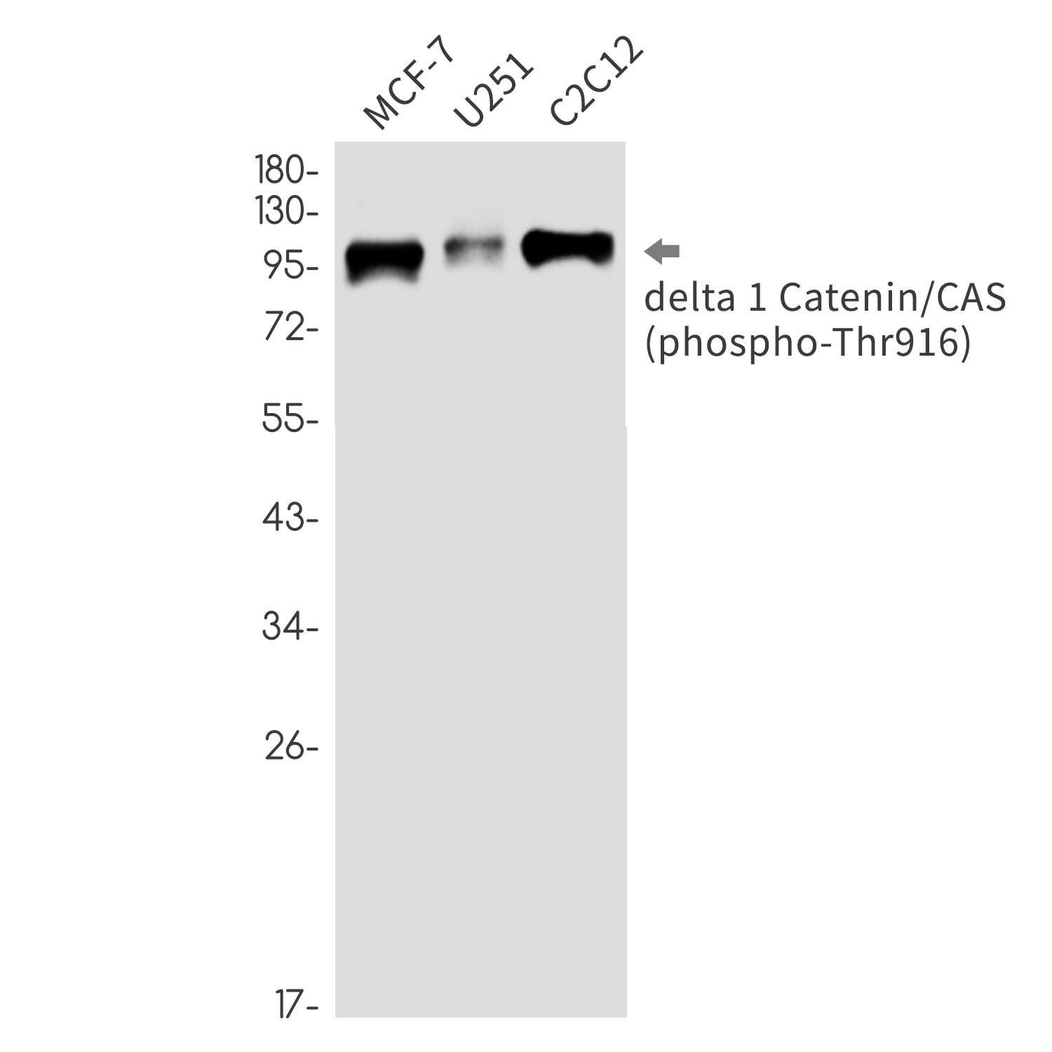 Phospho-delta 1 Catenin (Thr916) (YD33271) Rabbit mAb