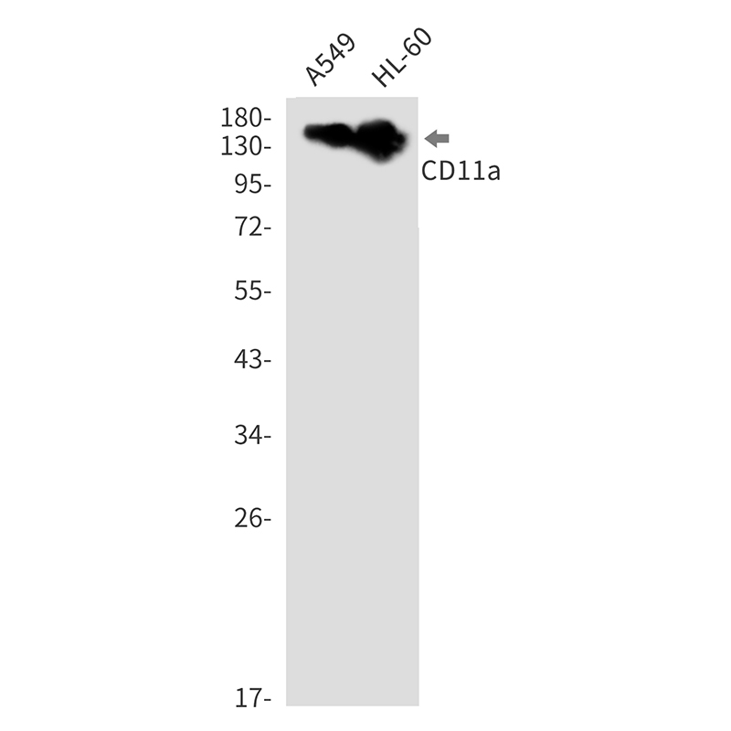 Integrin alpha L (YD31690) Rabbit mAb