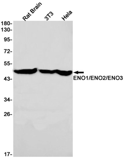 AYD11450