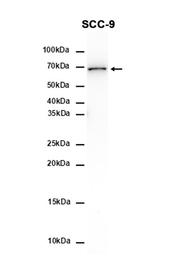 AYD11654