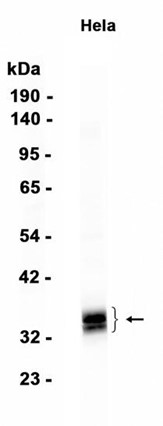 AYD14933