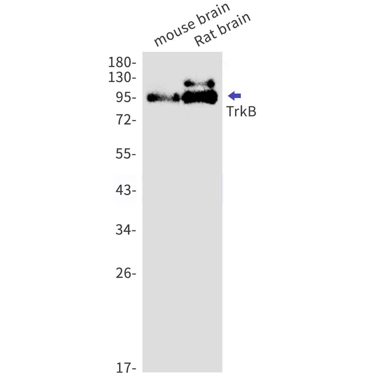 TrkB (YD14736) Rabbit mAb