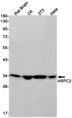 AYD11566