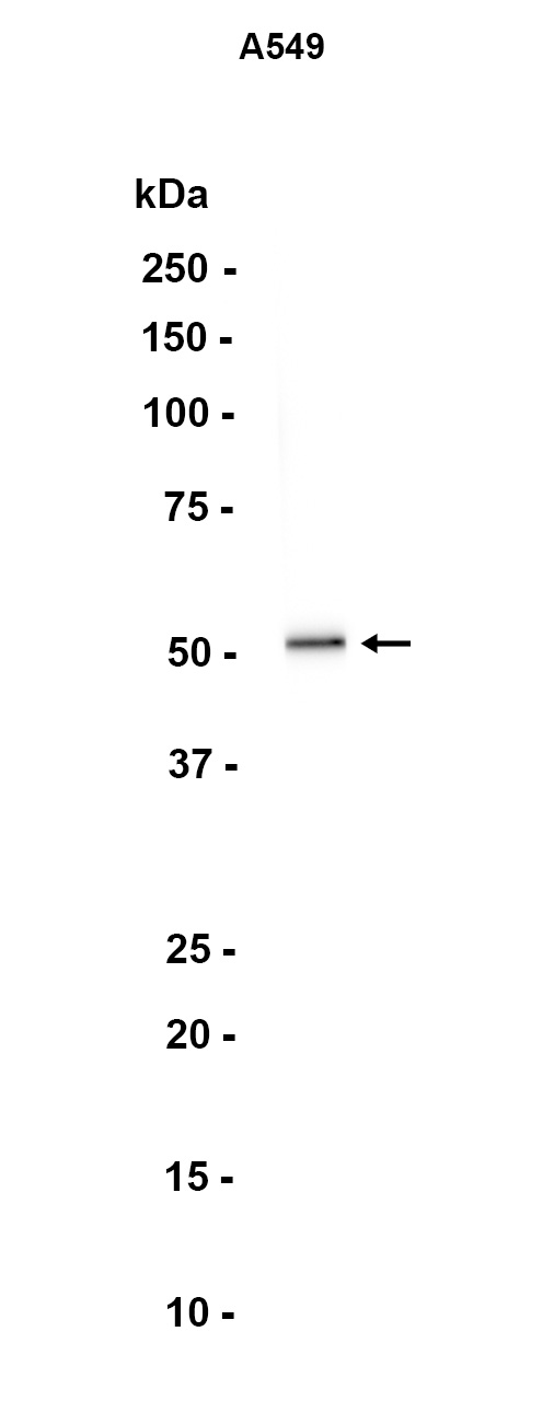 AYD11845