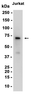 AYD14907