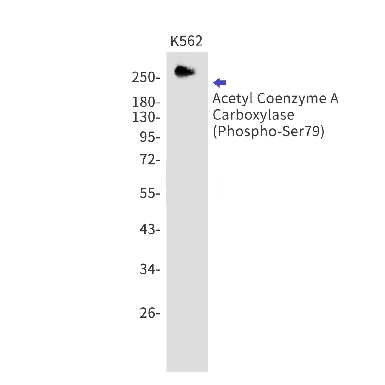 Phospho-Acetyl Coenzyme A Carboxylase (Ser79) (YD16020) Rabbit mAb