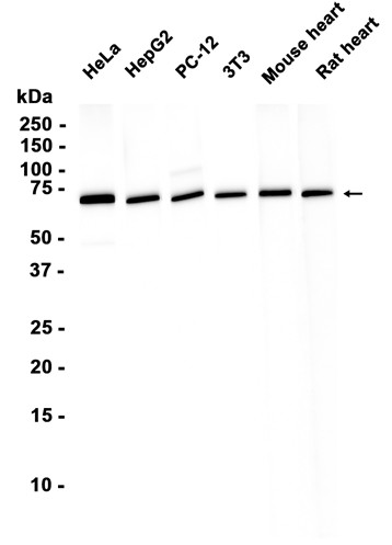 Lamin B1 (YD16498) Rabbit mAb