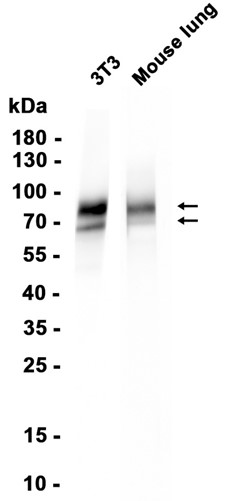 IL-1 Receptor I (YD16884) Rabbit mAb