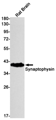 AYD11816