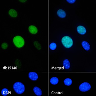 p21 (YD15110) Rabbit mAb