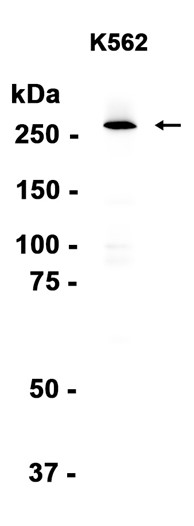 AYD15906