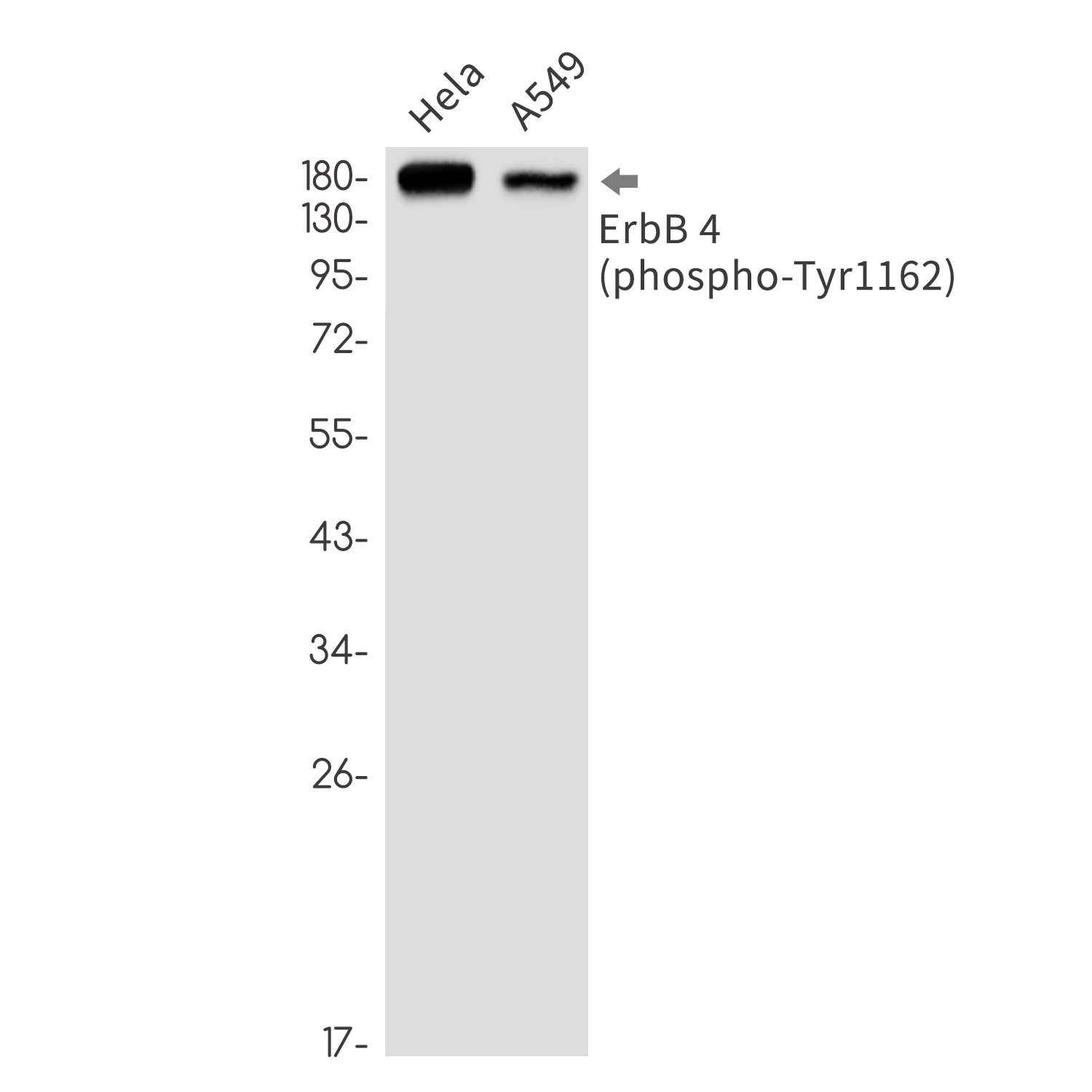 Phospho-ErbB 4 (Tyr1162) (YD34251) Rabbit mAb