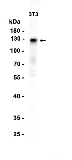Ephrin receptor A2 (YD18478) Rabbit mAb