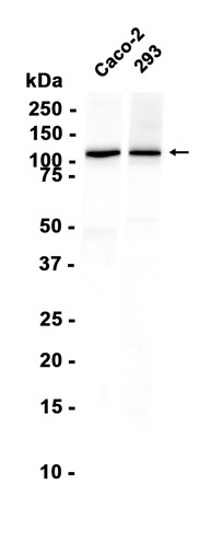 UBE4A (YD36270) Rabbit mAb