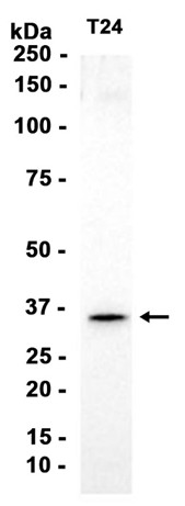 AYD14264